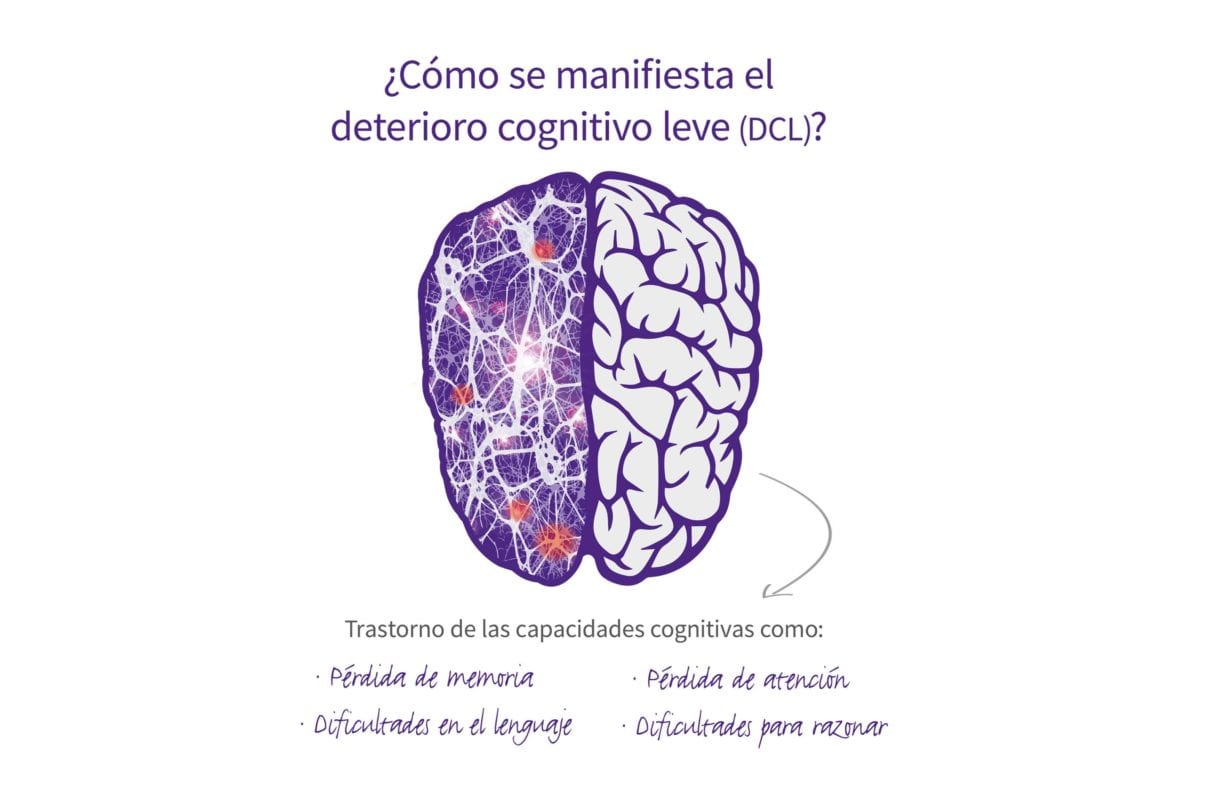 ¿Cómo se manifiesta el deterioro cognitivo?